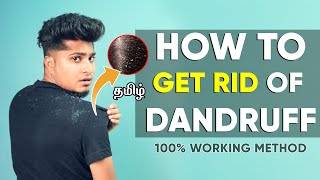 TOP SECRET Tips to REMOVE DANDRUFF Forever | IN TAMIL | SARAN LIFESTYLE