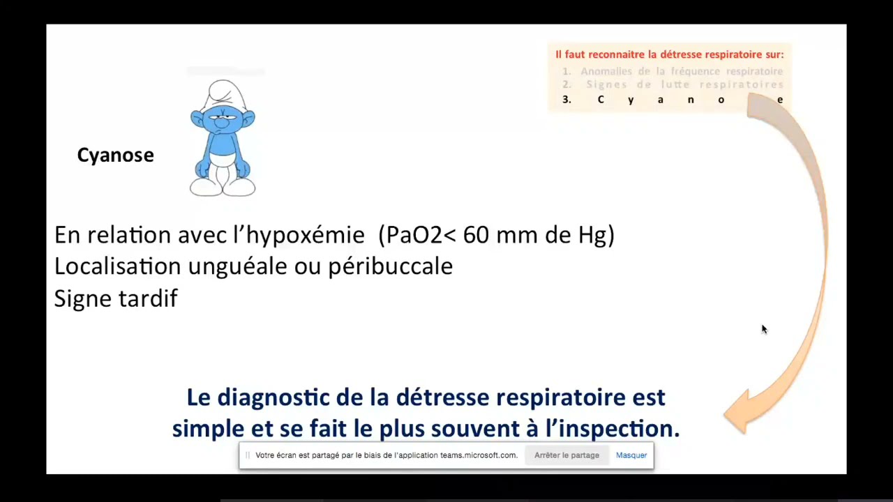 Détresses respiratoires du nourrisson et de l'enfant Pr Lamya Karboubi