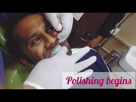 Dr. Malik’s Dental Clinic | YouTuber Irshaad | blog by Irshaad Siddiqui #dentist #dental