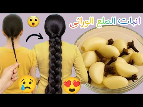 ضعيه على شعرك ليلة واحدة قسما بالله☝هيخلي شعرك زي الباروكة‼️تطويل وإنبات ووقف التساقط نهائيا من مره