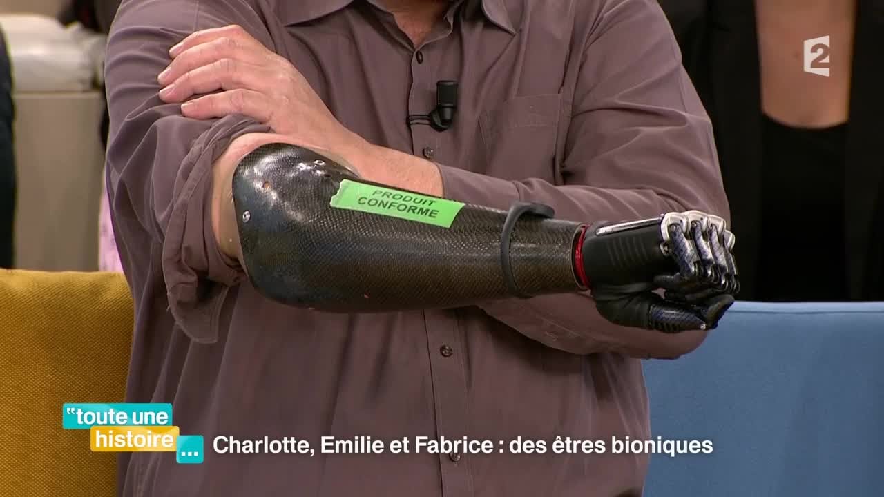 Vivre avec une main bionique au quotidien 