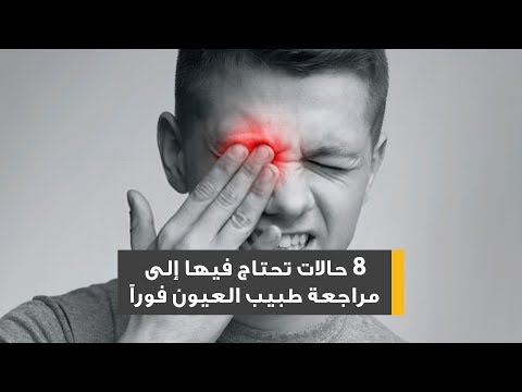 فيديو: ماذا يفعل طبيب العيون؟