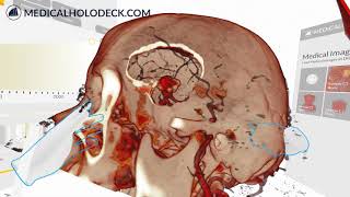 Measure and Mask DICOM in Virtual Reality