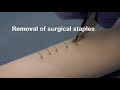 Placing and removing surgical wound closure staples