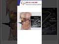 Whole Abdominal Ultrasound #draliwaqar #ultrasound
