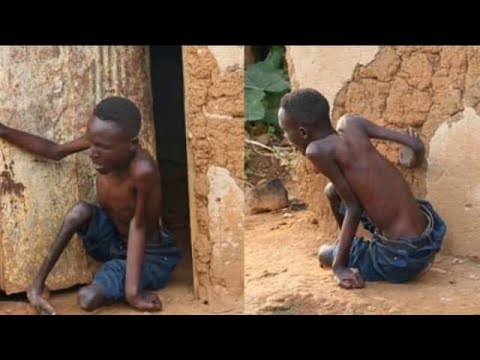 Papa Yarantaye Aranyanga Ngomfite Ubumuga Nararyamye Nsanga Mezuku Ubuzima Bwarambihiye 