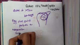 3 8 giant cell tumor mp4 || ORTHOPEDICS