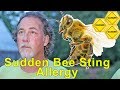 Warning: Sudden Bee Sting Allergy - Signs, Symptoms, and Dangers of Anaphylaxis