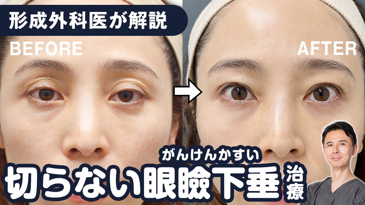 EYEeyelid surgeryセレクト美容塾・眼瞼　美容外科形成外科 セレクト美容塾・眼瞼 | 美容塾 |本 | 通販 | Amazon