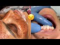 Most Extreme Beauty Treatments 2021 Best Smart and Helpful Beauty Hacks | Virtual Beauty