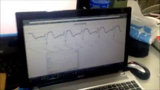 Demo － How to collect data by patch and ambient sensor