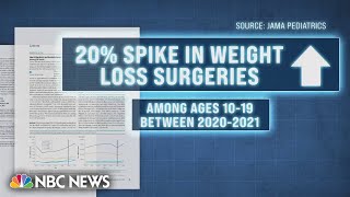 Weight loss surgeries spiking among children and young adults, study finds