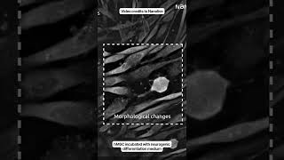 Can Stem Cells Shape Into Neuronal Cells?