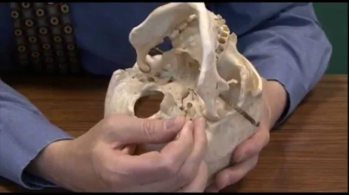 Brain 1, Brain and skull