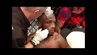 Celebrity Edwards vs. Barberena | Fight Highlights Net Worth
