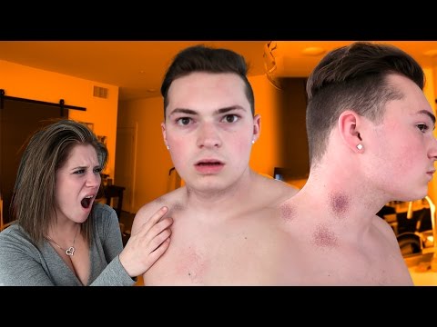 girlfriend-finds-hickeys-on-boyfriend..