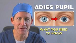 Adies Pupil Explained Why One Pupil Is Larger & Light Sensitivity