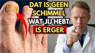 Al jaren gele teennagels zonder verbetering? Je voeten waarschuwen je voor iets ergers
