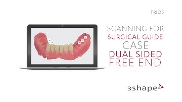 3Shape TRIOS Scanning for surgical guide - Dual Sided Free End Case