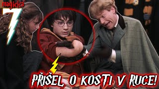 7 NEJHORŠÍCH ZRANĚNÍ HARRYHO POTTERA