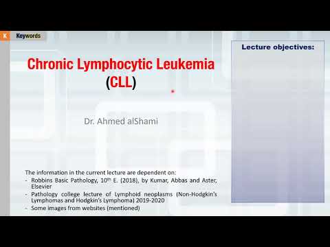 Video: Monoallelične I Bialeličke Delecije 13q14 U Skupini Bolesnika S CLL / SLL-om Koje Su Ispitivale CGH Hematološki Karcinom I SNP Niz (8x60K)