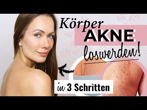 Video: Akne Auf Dem Rücken, Wie Man Es Beseitigt