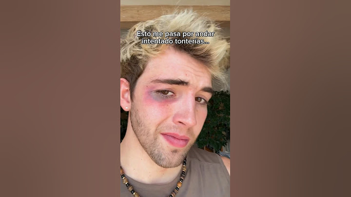 Me encanta lastimarme de las maneras más TONTAS!!🤕😓🤦🏼‍♂️