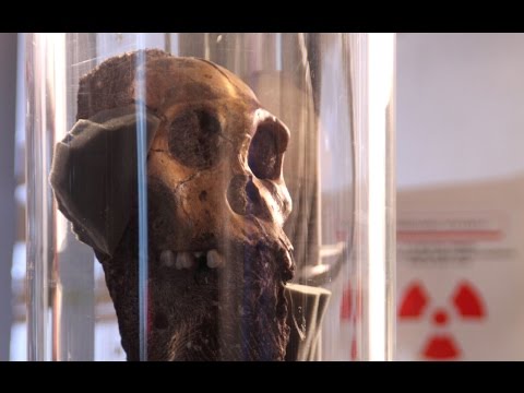 Earliest cancer in a hominin