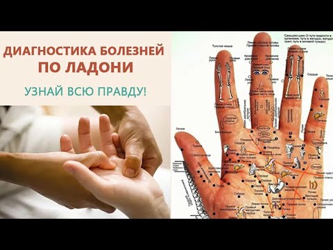 Руки ЧЕЛОВЕКА - КЛАДЕЗЬ всевозможной информации! Диагностика БОЛЕЗНЕЙ по ЛАДОНЯМ!