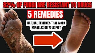 Cracked Heels? Rub THIS on Your Feet and They’ll Be Soft Again (5 Natural Remedies) screenshot 2