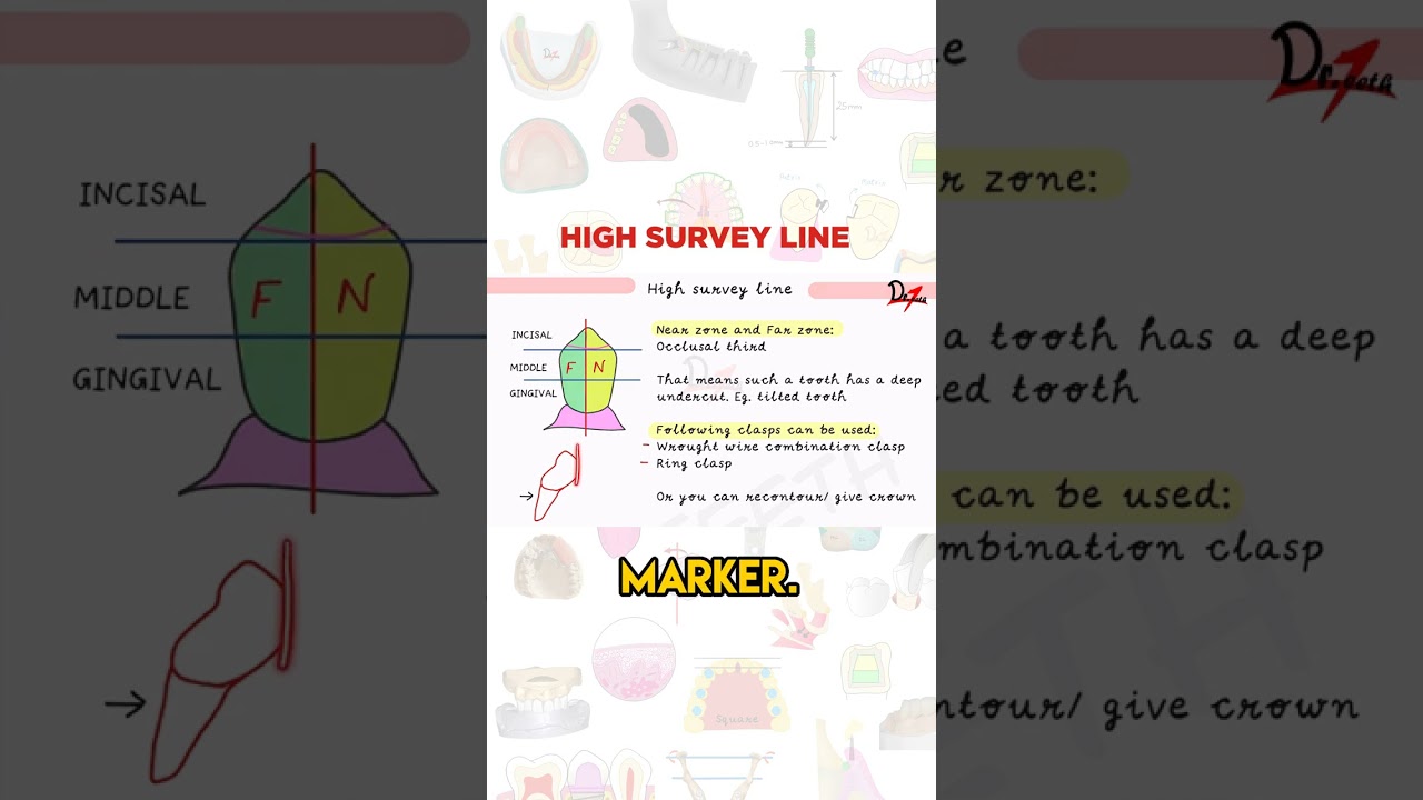 Высокая линия обследования