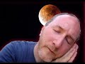 Multiple Sclerosis and SLEEP! LIVE STREAM with Dr. B!
