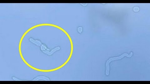 Got Floaty in Your Eyes? : What They Are and How They Work