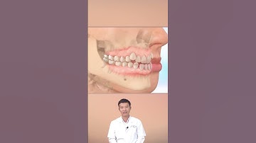 Niềng Răng Móm?! | Nha Khoa Minh Châu