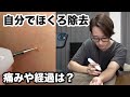 自分でほくろ取ってみた #ほくろ除去ペン