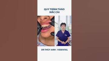 Quy trình tháo mắc cài #nhakhoa #nhasi #rangmieng #niengrang #rangnieng #braces #shorts