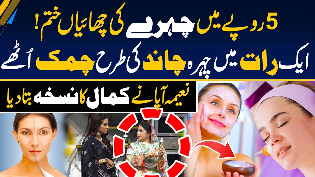 5 Rupy Mein Chehry Ki Chaiyan Khatam - Easy Way To Remove Freckles On Face - Best Treatments