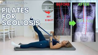 Pilates for Scoliosis with a Band | 20 Minute Routine to help you feel more balanced