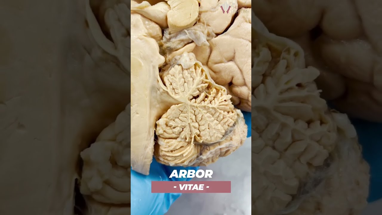 The Inside Of Your Brain Has A Tree