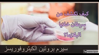 ماذا يعني ارتفاع بروتينات البلازم في الدم serum protein electrophoresis