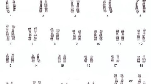 International System for Human Cytogenomic Nomenclature ISCN guidelines for Describing Karyotypes
