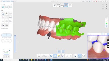 Medit i700W Scanning Techniques