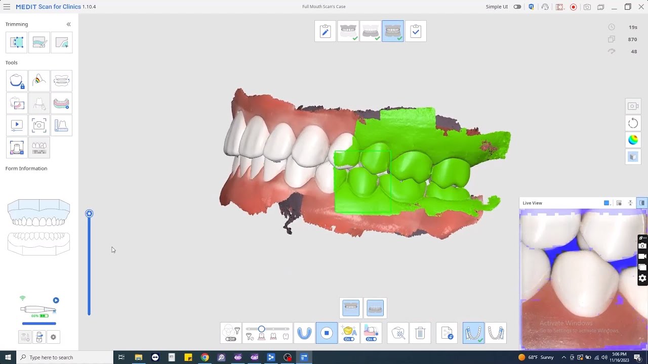 Medit i700W Scanning Techniques