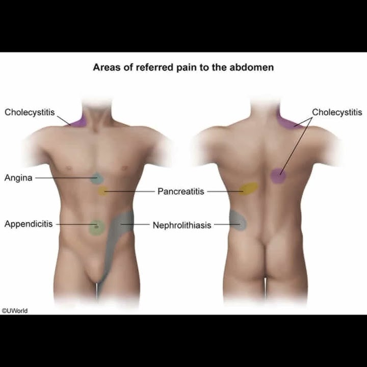 Areas of reffered Pain in abdomen #pain #refferedpain #abdominalpain