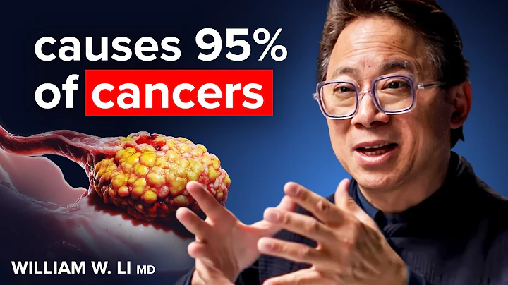 4 Foods to Stop Cancer (Scientific Proof) | Dr. William Li
