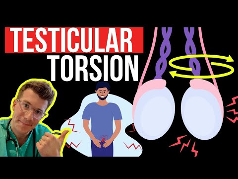 Doctor explains TESTICULAR TORSION (twisting of the testicle) | Symptoms, causes and surgery