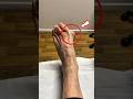 This Is Why Your Big Toe Is Shifting 🦶 #bunions #foothealth #podiatry #bunionrelief