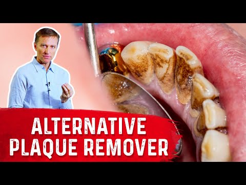 Get Rid of Plaque and Tartar Using Only 3 Ingredients