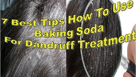 7 Best Tips How To Use Baking Soda For Dandruff Treatment