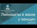 418  Лейкоциты в мазке у женщин